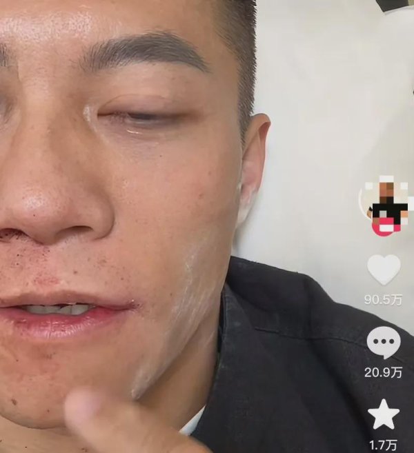 希恩配资网 中国男子参加扇耳光大赛倒地，本人发声